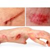 SilverSeal Hydrogel Wound Care Kit with Antimicrobial Silver Pads-4